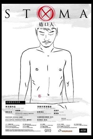 Stoma streaming