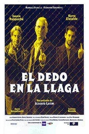 El dedo en la llaga streaming